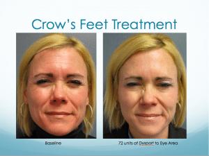 Crow's Feet Eye Wrinkle Treatment
