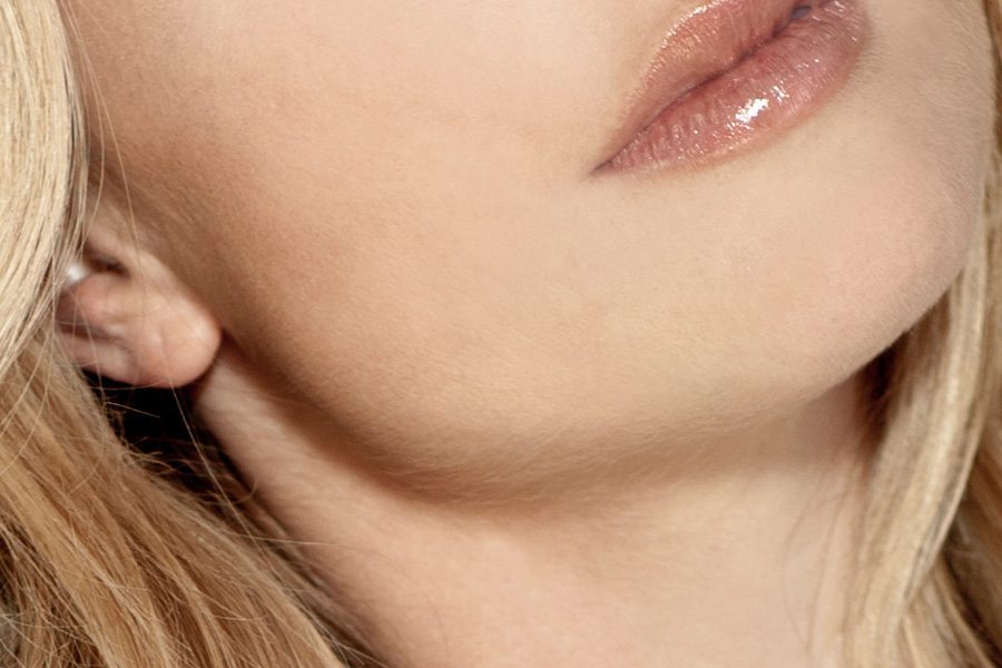 Skin Treatments and Resurfacing Before and After San Diego
