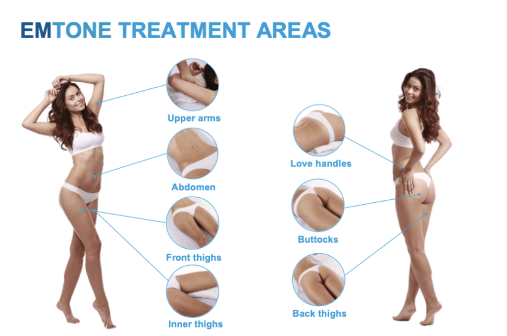 emtone treatment areas