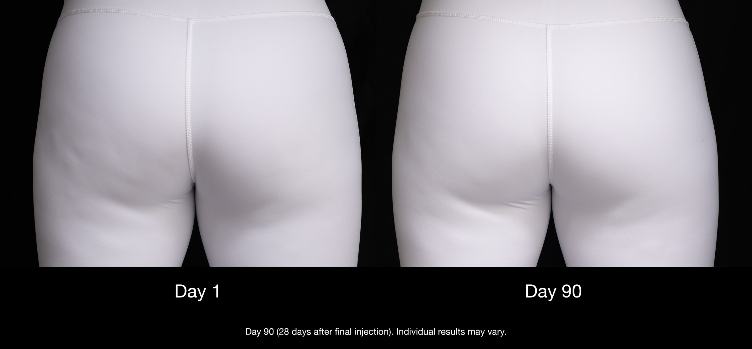Qwo cellulite smooth skin