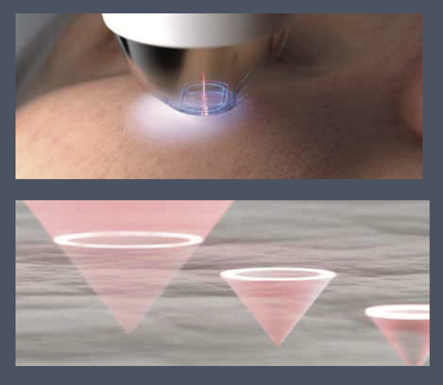 avava laser san diego dr melanie palm