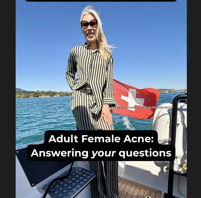 adult female acne causes and treatment dr melanie palm